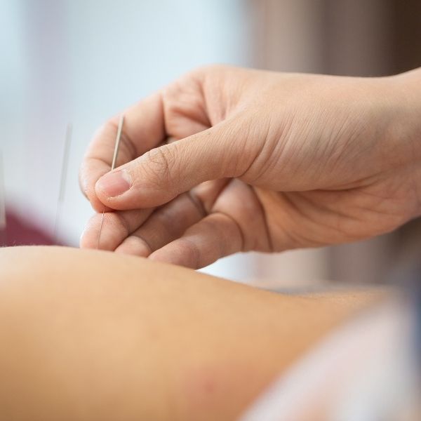 Acupuncture neutral bay